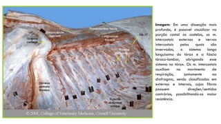 Imagem: Em uma dissecção mais
profunda, é possível visualizar na
porção costal as costelas, os m.
intercostais externos e nervos
intercostais pelos quais são
invervados, o sistema longo
longuíssimo do tórax e a fáscia
tóraco-lombar, abrigando esse
sistema no tórax. Os m. intercostais
auxiliam no movimento de
respiração, juntamente ao
diafragma, sendo classificados em
externos e internos, cujas fibras
possuem direções/sentidos
contrários, possibilitando-os maior
resistência.
 