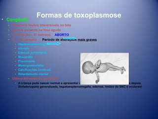 • Congênita
­
­
­
­

Formas de toxoplasmose

Possíveis lesões irreversíveis no feto
Ocorre somente na fase aguda
Concepção – 6° semana ABORTO
6° - 16° semana
Período de alterações mais graves
­
­
­
­
­
­
­
­

Hepatoesplenomegalia
Icterícia
Edemas pulmonares
Miocardite
Pneumonite
Meningoencefalite
Calcificações cerebrais
Retardamento mental

­ Ultimo trimestre de gestação
­ A criança pode nascer normal e apresentar sinais da doença semanas ou meses depois
(linfadenopatia generalizada, hepatoesplenomegalia, edemas, lesões do SNC e oculares)

 