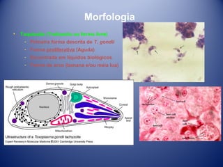 Morfologia
•

Taquizoíto (Trofozoíto ou forma livre)
­ Primeira forma descrita de T. gondii
­ Forma proliferativa (Aguda)
­ Encontrada em líquidos biológicos
­ Forma de arco (banana e/ou meia lua)

 