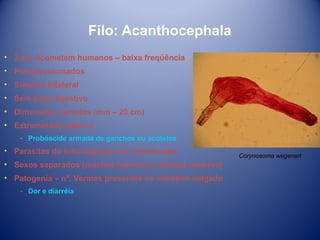 Filo: Acanthocephala
• 2 sp. Acometem humanos – baixa freqüência
• Pseudocelomados
• Simetria bilateral
• Sem tubo digestivo
• Dimensões variadas (mm – 20 cm)
• Extremidade anterior
­ Probóscide armada de ganchos ou acútelos

• Parasitas do tubo digestivo de vertebrados
• Sexos separados (machos menores e fêmeas maiores)
• Patogenia – nº. Vermes presentes no intestino delgado
­ Dor e diarréia

Corynosoma wegeneri

 