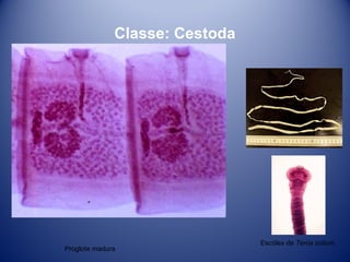 Classe: Cestoda

Proglote madura

Escólex de Tenia solium.

 