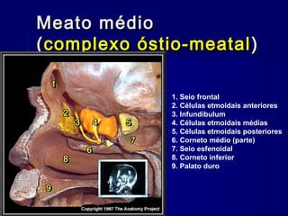 Meato médioMeato médio
((complexo óstio-meatalcomplexo óstio-meatal ))
1. Seio frontal
2. Células etmoidais anteriores
3. Infundibulum
4. Células etmoidais médias
5. Células etmoidais posteriores
6. Corneto médio (parte)
7. Seio esfenoidal
8. Corneto inferior
9. Palato duro
 