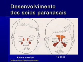 DesenvolvimentoDesenvolvimento
dos seios paranasaisdos seios paranasais
Recém-nascido 10 anos
Óstios são amplos e cavidades
 