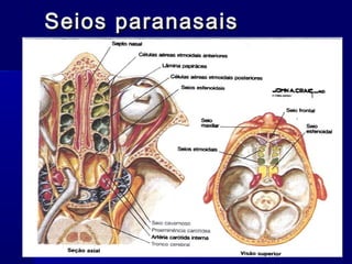 Seios paranasaisSeios paranasais
 
