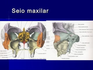 Seio maxilarSeio maxilar
 