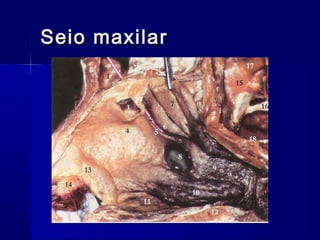 Seio maxilarSeio maxilar
 