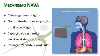 ➢ Cateter gastroesofágico
➢ Grupos de eletrodos na porção
distal do esôfago
➢ Captação dos estímulos
elétricos diafragmáticos
➢ Interação Paciente x Ventilador
MECANISMO NAVA
 