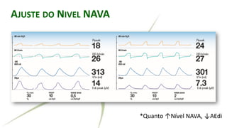 RALLY ADJUSTED VENTILATORY ASSIST
*Quanto ↑Nível NAVA, ↓AEdi
AJUSTE DO NIVEL NAVA
 