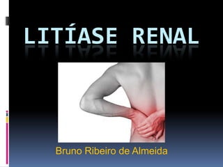 LITÍASE RENAL



  Bruno Ribeiro de Almeida
 