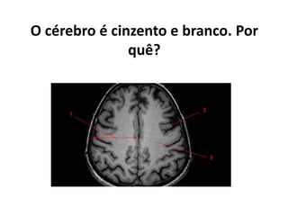 O cérebro é cinzento e branco. Por
quê?
 
