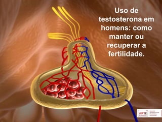 Uso de
testosterona em
homens: como
manter ou
recuperar a
fertilidade.
 