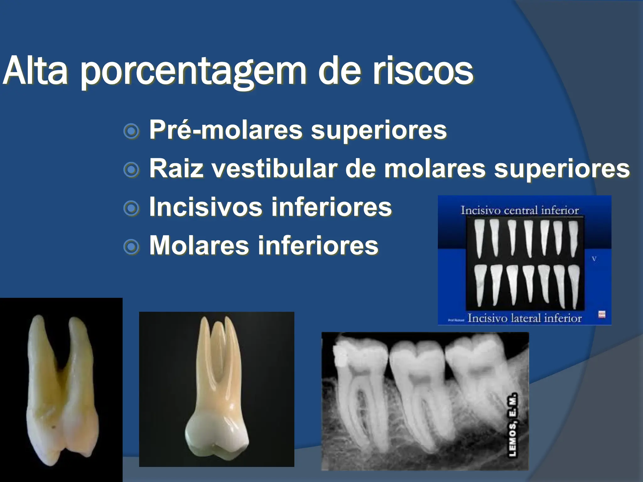 Aula Nucleo metalico fundido para dentes tratados endodonticamente | PDF
