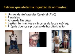    Um Acidente Vascular Cerebral (AVC)
   Paralisias
   Anorexia Nervosa
   Lesões, ferimentos e cânceres de face e esôfago
   Própria doença e processo de hospitalização
 