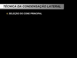 TÉCNICA DA CONDENSAÇÃO LATERAL 4.  SELEÇÃO DO CONE PRINCIPAL   