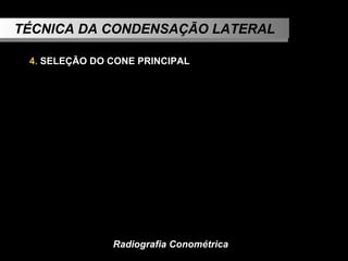 TÉCNICA DA CONDENSAÇÃO LATERAL 4.  SELEÇÃO DO CONE PRINCIPAL   Radiografia Conométrica 