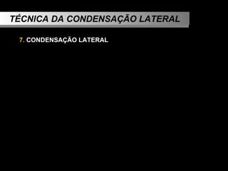 TÉCNICA DA CONDENSAÇÃO LATERAL 7.  CONDENSAÇÃO LATERAL 