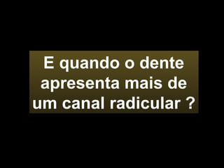 E quando o dente apresenta mais de um canal radicular ? 