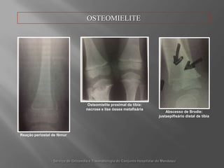 Circulaçãocapilartérmino-terminal, que impede o prosseguimento de êmbolosbacterianos.