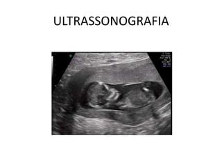ULTRASSONOGRAFIA

 