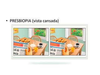 • PRESBIOPIA (vista cansada)

 