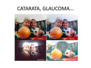 CATARATA, GLAUCOMA...

 