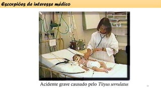 Acidente grave causado pelo Tityus serrulatus
Escorpiões de interesse médico
20
 