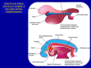 EFEITO DA PRGA
CEFÁLICA SOBRE O
 CELOMA INTRA-
  EMBRIONÁRIO
 