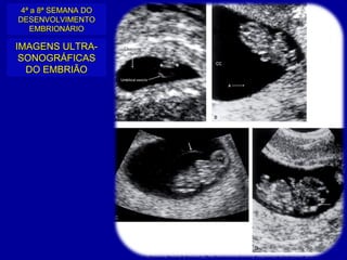 4ª a 8ª SEMANA DO
DESENVOLVIMENTO
   EMBRIONÁRIO

IMAGENS ULTRA-
 SONOGRÁFICAS
  DO EMBRIÃO
 