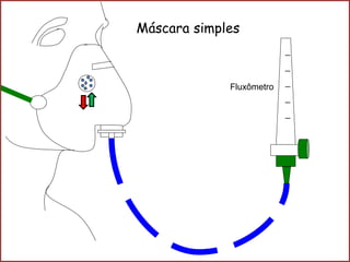 _
_
_
_
_
Máscara simples
Fluxômetro
 