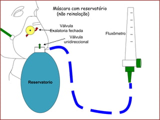 _
_
_
_
_
Reservatorio
Válvula
unidireccional
Máscara com reservatório
(não reinalação)
Válvula
Exalatoria fechada
Fluxômetro
 