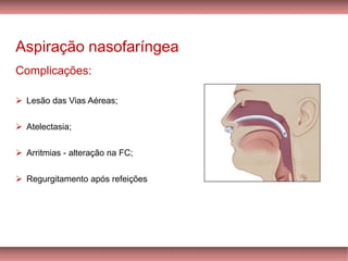 Aspiração nasofaríngea
Complicações:
➢ Lesão das Vias Aéreas;
➢ Atelectasia;
➢ Arritmias - alteração na FC;
➢ Regurgitamento após refeições
 