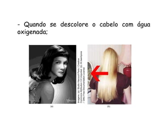 QUÍMICA, 3ª ANO
Oxirredução (Regras do Nox)
- Quando se descolore o cabelo com água
oxigenada;
(a)
Imagens:
(a):
Studio
Harcourt
Paris
/
Creative
Commons
Attribution
3.0
Unported
(b):
Kt.twentyone
/
GNU
Free
Documentation
License
(b)
 