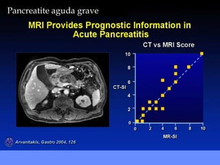 Pancreatite aguda grave
 