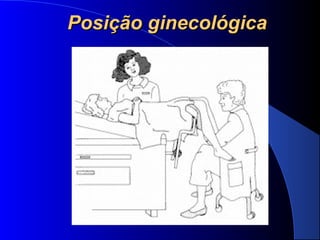 Posição ginecológicaPosição ginecológica
 