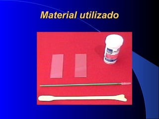 Material utilizadoMaterial utilizado
 