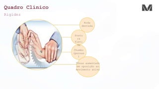 Quadro Clínico
Rigidez
Roda
dentada
Postu
ra
fleti
da
Chumbo
(pernas
)
Tônus aumentado
em oposição ao
movimento ativo
 