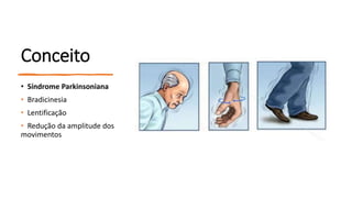 Conceito
• Síndrome Parkinsoniana
• Bradicinesia
• Lentificação
• Redução da amplitude dos
movimentos
 