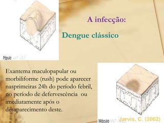 6
Exantema maculopapular ou
morbiliforme (rush) pode aparecer
nasprimeiras 24h do período febril,
no período de defervescência ou
imediatamente após o
desaparecimento deste.
A infecção:
Dengue clássico
Jarvis, C. (2002)
 