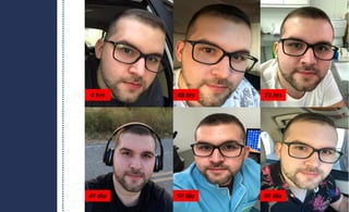 4 hrs 48 hrs 72 hrs
4º dia 5º dia 6º dia
 