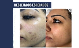 RESULTADOS ESPERADOS
 