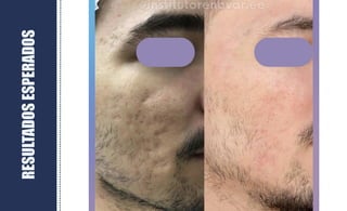 RESULTADOS
ESPERADOS
 