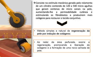 Consiste no estímulo mecânico gerado pelo rolamento
de um cilindro contendo de 120 a 540 micro agulhas
que geram centenas de micro canais na pele,
aumentando-lhe a permeabilidade cutânea e
estimulando os fibroblastos a produzirem mais
colágeno para restaurar o tecido conjuntivo.
 