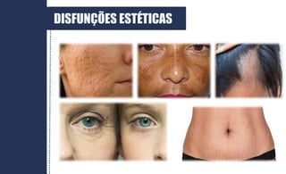 DISFUNÇÕES ESTÉTICAS
 