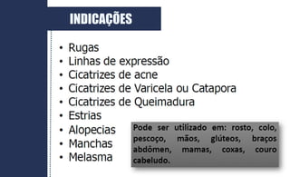 INDICAÇÕES
 