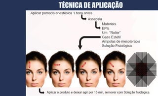 TÉCNICA DE APLICAÇÃO
 