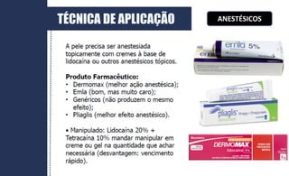ANESTÉSICOS
TÉCNICA DE APLICAÇÃO
 