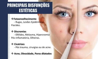 PRINCIPAIS DISFUNÇÕES
ESTÉTICAS
Fotoenvelhecimento
- Rugas, Lesões Epidérmicas,
Flacidez.
 Discromias
- Efélides, Melasma, Hipercromia
Pós-Inflamatória, Olheiras.
 Cicatrizes
- Pós trauma, cirurgias ou de acne.
 Acne, Oleosidade, Poros dilatados
 