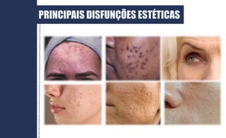 PRINCIPAIS DISFUNÇÕES ESTÉTICAS
 