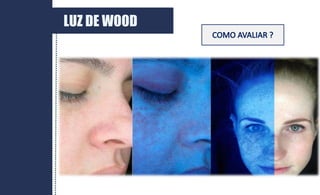 LUZ DE WOOD
 