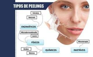 TIPOS DE PEELINGS
FÍSICOS
QUÍMICOS
ENZIMÁTICOS
INJETÁVEIS
Lasers
Microdermoabrasão
Naturais
Extratos
Mesoterapia
Ácidos
Básicos
 